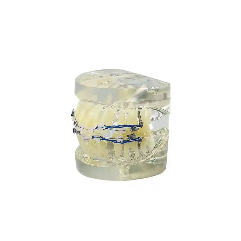 Applying orthodontic brackets and chain ties to a dental model for orthodontic study