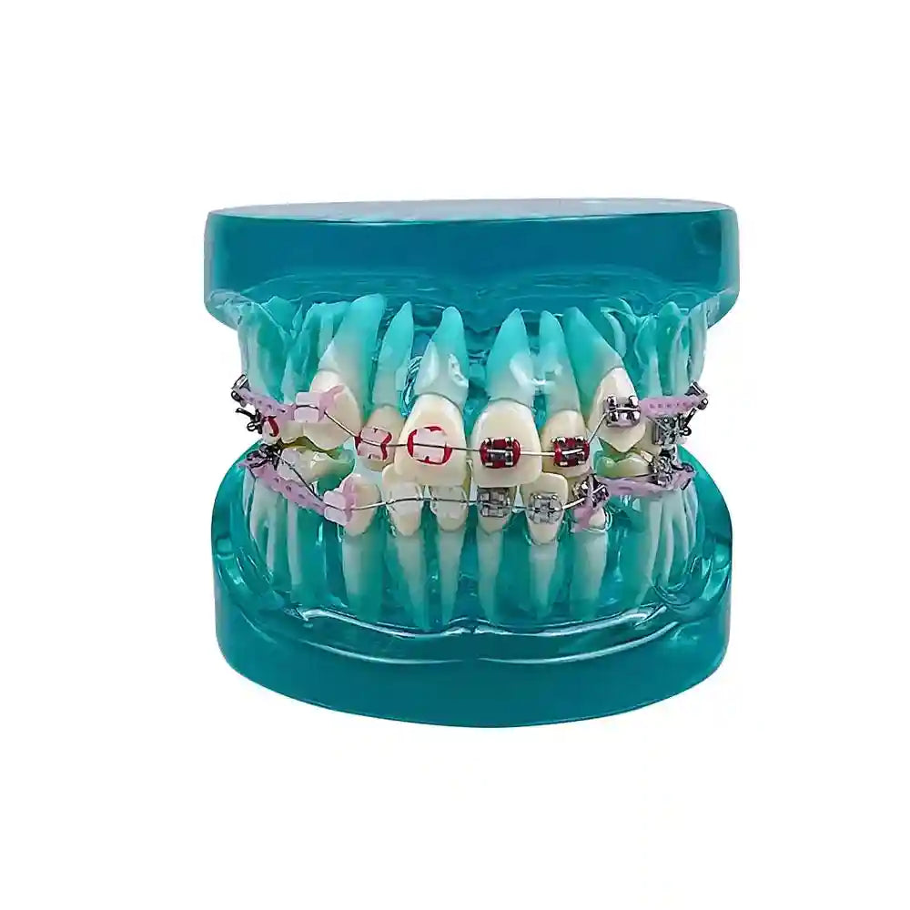 Applying orthodontic brackets and chain ties to a dental model for orthodontic study