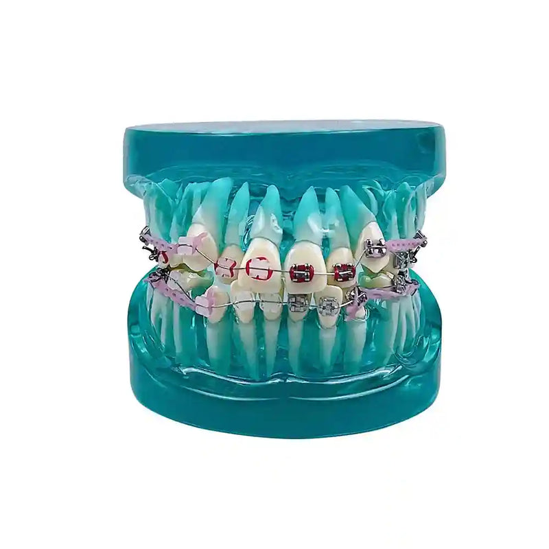 Applying orthodontic brackets and chain ties to a dental model for orthodontic study