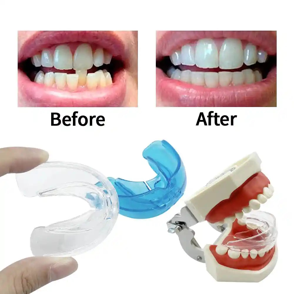 Adult wearing transparent teeth trainer aligner for orthodontic treatment at home
