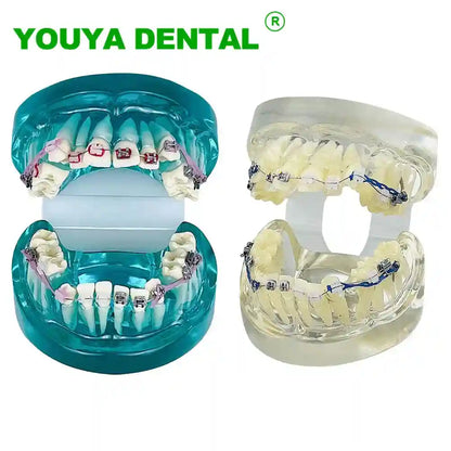 Applying orthodontic brackets and chain ties to a dental model for orthodontic study