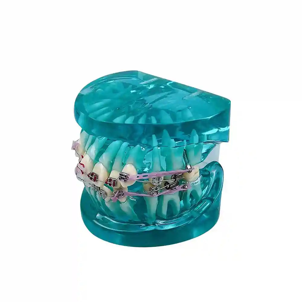 Applying orthodontic brackets and chain ties to a dental model for orthodontic study