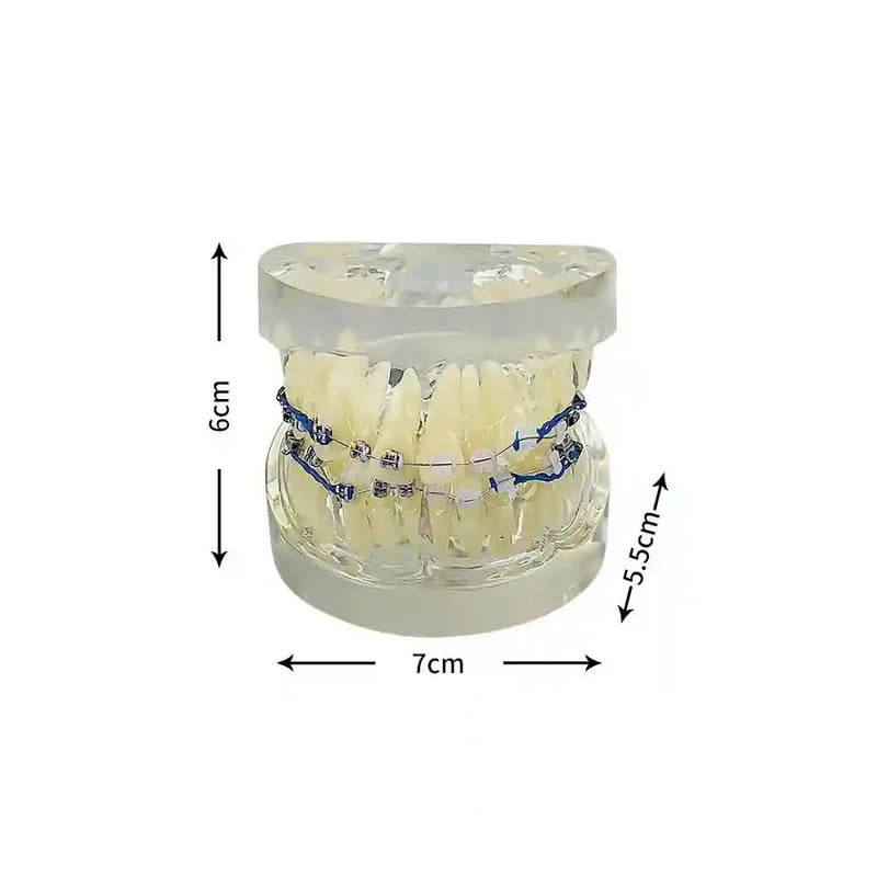 Applying orthodontic brackets and chain ties to a dental model for orthodontic study