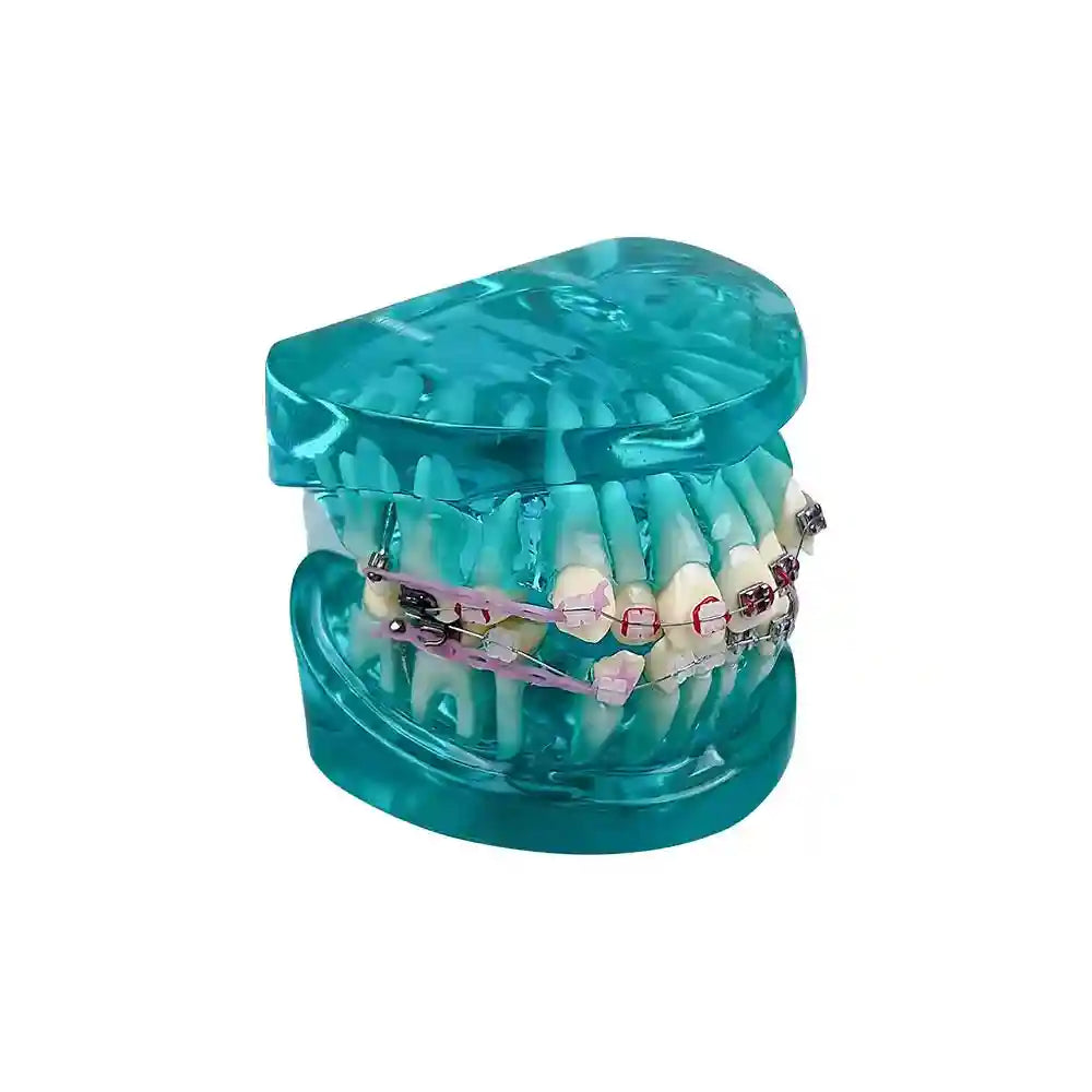 Applying orthodontic brackets and chain ties to a dental model for orthodontic study