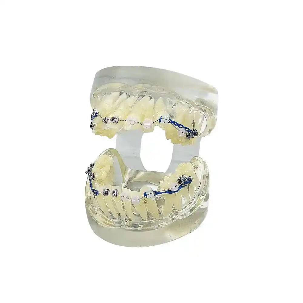 Applying orthodontic brackets and chain ties to a dental model for orthodontic study