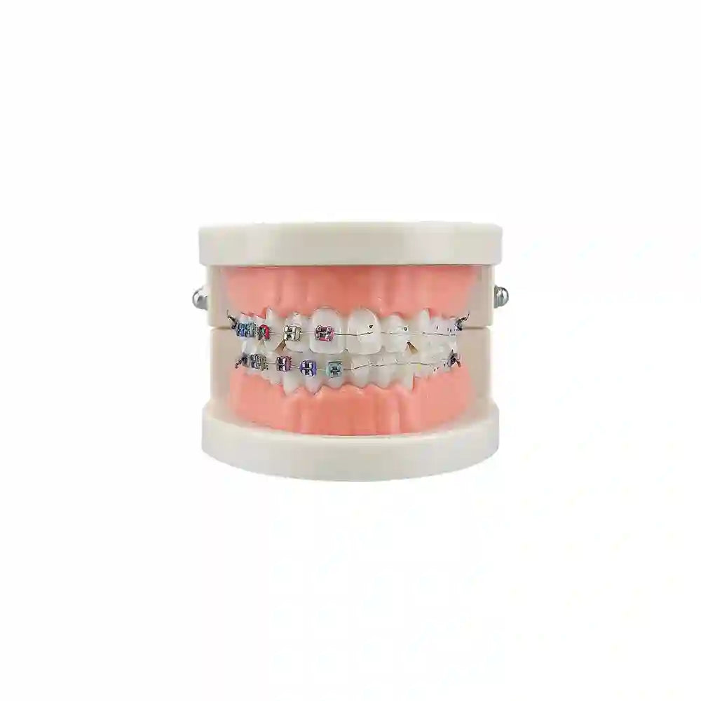 Dental student practicing orthodontic techniques on the Dental Orthodontic Teeth Model with braces.