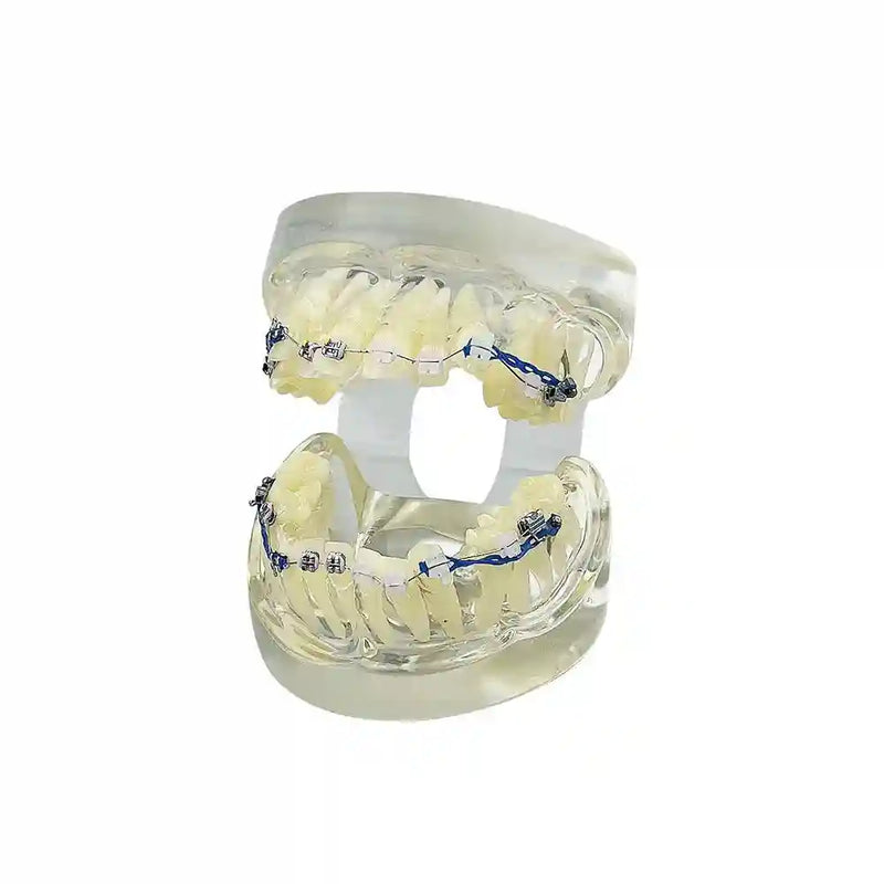 Applying orthodontic brackets and chain ties to a dental model for orthodontic study