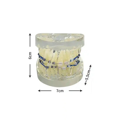 Applying orthodontic brackets and chain ties to a dental model for orthodontic study